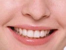Почему наши зубы разрушаются?